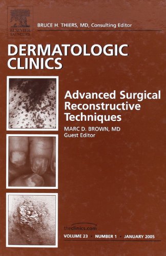 Imagen de archivo de Advanced Surgical Techniques, An Issue of Dermatologic Clinics (Volume 23-1) (The Clinics: Dermatology, Volume 23-1) a la venta por HPB-Red
