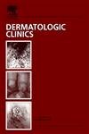 Stock image for Dermatologic Therapy: An Issue of Dermatologic Clinic (The Clinics: Dermatology, Volume 23-2) for sale by HPB-Red