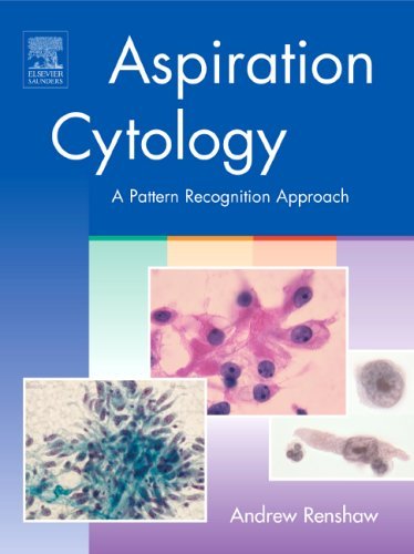 Aspiration Cytology: A Pattern Recognition Approach, 1e - Andrew A. Renshaw