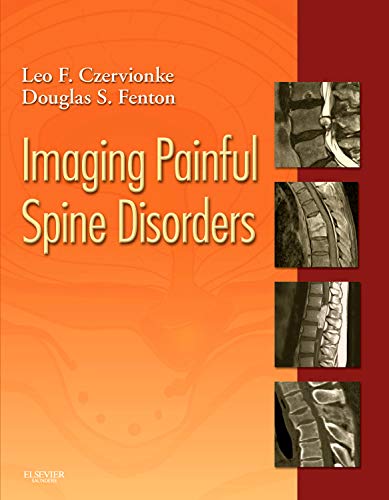 Stock image for Imaging Painful Spine Disorders for sale by Better World Books