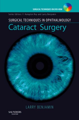 Stock image for Cataract Surgery for sale by Better World Books Ltd