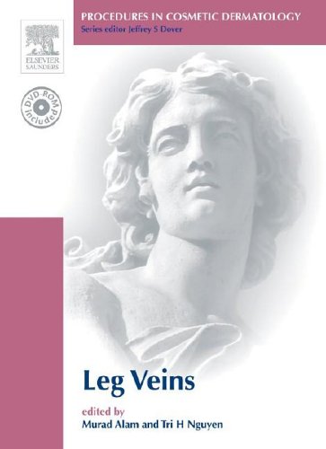 9781416031598: Procedures in Cosmetic Dermatology Series: Treatment of Leg Veins: Text with DVD