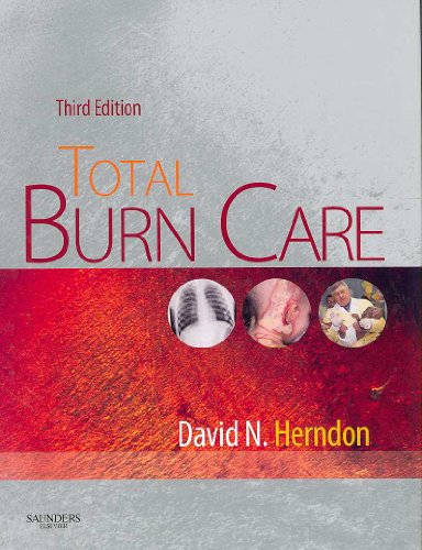 9781416032748: Total Burn Care,