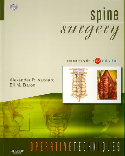 Stock image for Spine Surgery for sale by Better World Books