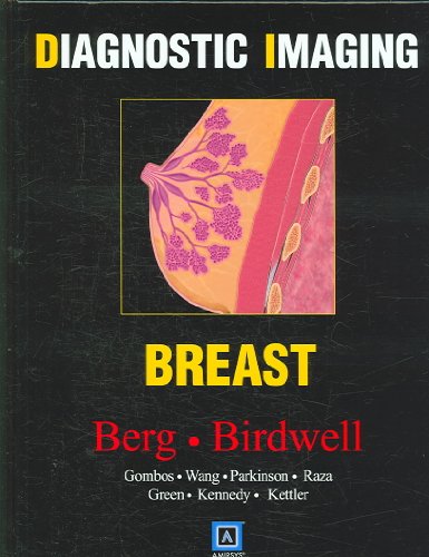 Diagnostic Imaging: Breast (9781416033370) by Wendie A. Berg; Robyn L. Birdwell; Eva Gombos; Shih-Chang Wang; Brett Parkinson; Sughra Raza; Gretchen Green; Anne Kennedy; Mark D. Kettler