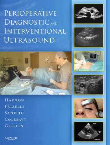 Imagen de archivo de Perioperative Diagnostic and Interventional Ultrasound with DVD a la venta por HPB-Red