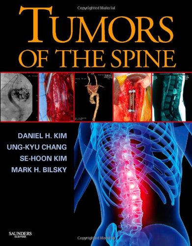 Tumors of the Spine (9781416033677) by Kim MD FACS, Daniel H.; Chang MD PhD, Ung-kyu; Kim MD PhD, Se-Hoon; Bilsky MD, Mark H.