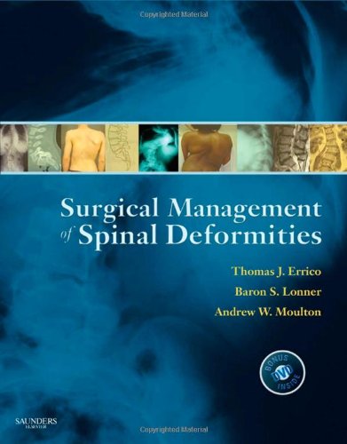 Imagen de archivo de Surgical Management of Spinal Deformities a la venta por Better World Books