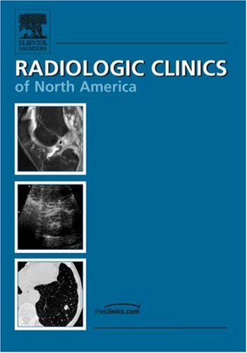 9781416033844: Neuroradiology Essentials: An Issue of Radiologic Clinics