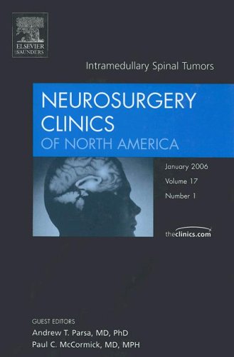 Intramedullary Spinal Tumors, An Issue of Neurosurgery Clinics (Volume 17-1) (The Clinics: Surgery, Volume 17-1) (9781416034650) by Parsa MD, Andrew T.; McCormick MD MPH FACS, Paul