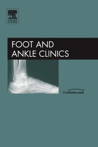 Beispielbild fr Posttraumatic Reconstruction of the Foot and Ankle, zum Verkauf von CSG Onlinebuch GMBH