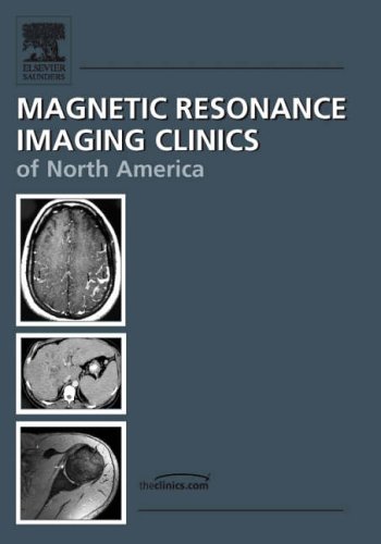 Stock image for Breast MR Imaging (Magnetic Resonance Imaging Clinics of North America, Vol. 14, No. 3, August 2006) (Volume 14-3) for sale by HPB-Red