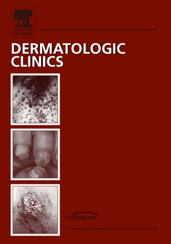 Imagen de archivo de Nail Disorders and Their Management, An Issue of Dermatologic Clinics (Volume 24-3) (The Clinics: Dermatology (Volume 24-3)) a la venta por Swan Trading Company