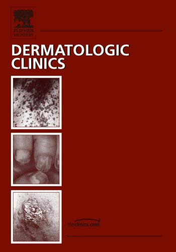 Stock image for Nail Disorders and Their Management, An Issue of Dermatologic Clinics (Volume 24-3) (The Clinics: Dermatology, Volume 24-3) for sale by HPB-Red