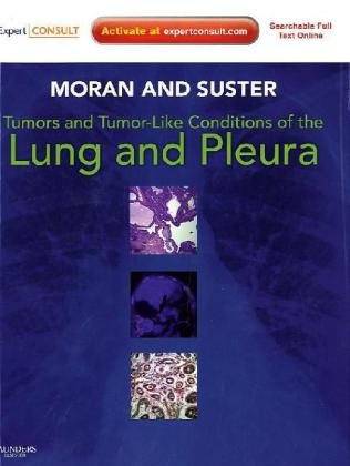 9781416036241: Tumors and Tumor-like Conditions of the Lung and Pleura: Expert Consult: Online and Print, 1e