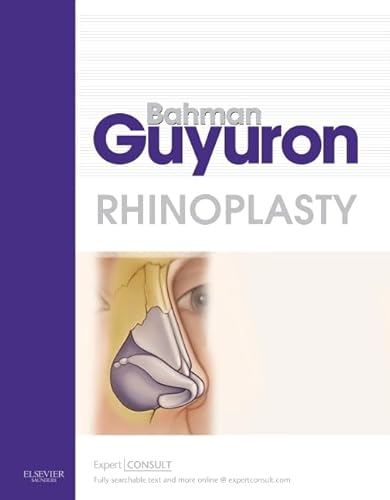 9781416037514: Rhinoplasty: Expert Consult Premium Edition - Enhanced Online Features and Print