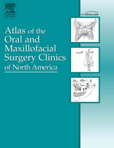 Stock image for Mandibular Reconstruction, An Issue of Atlas of the Oral and Maxillofacial Surgery Clinics (Volume 14-2) (The Clinics: Dentistry, Volume 14-2) for sale by -OnTimeBooks-