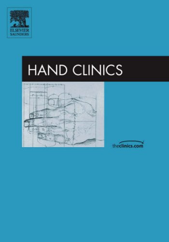 Beispielbild fr Hand Fractures and Dislocations, an Issue of Hand Clinics: Volume 22-3 zum Verkauf von ThriftBooks-Atlanta