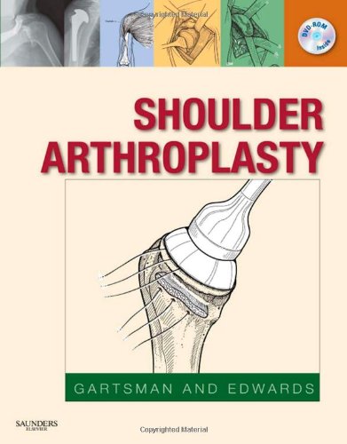 Stock image for Shoulder Arthroplasty for sale by Bookmans