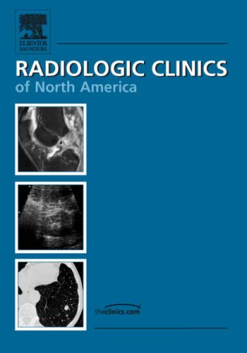 Imagen de archivo de 44 5 PROSTATE IMAGING RADIOLOGIC CLINICS a la venta por AG Library