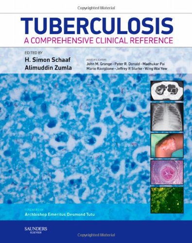Beispielbild fr Tuberculosis: A Comprehensive Clinical Reference zum Verkauf von WorldofBooks