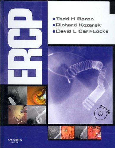 9781416042716: ERCP: Expert Consult - Online and Print, 1e