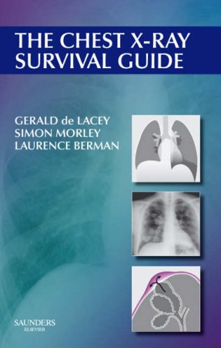 The Chest X-ray Survival Guide - Gerald de Lacey MA FRCR, Simon Morley FRCR, Laurence Berman MRCP FRCR