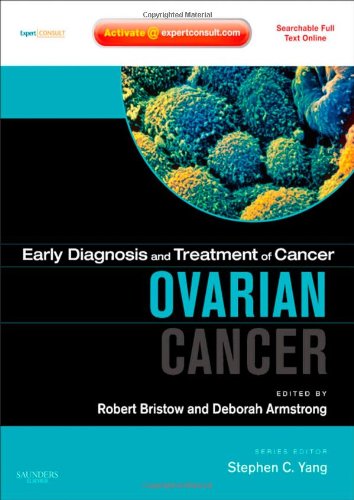 9781416046851: Ovarian Cancer with Expert Consult (Early Diagnosis and Treatment of Cancer Series)