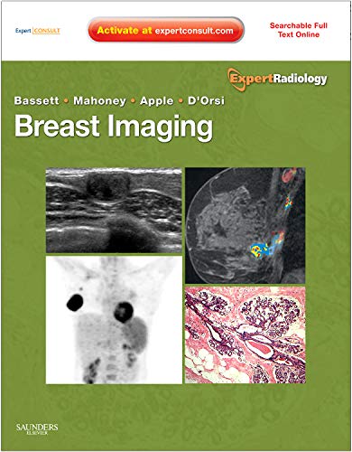 9781416051992: Breast Imaging: Expert Radiology Series, 1e