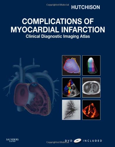 Complications of Myocardial Infarction: Clinical Diagnostic Imaging Atlas with DVD (Cardiovascular Emergencies: Atlas and Multimedia Series) - Hutchison MD FRCPC FACC FAHA FASE FSCMR FSCCT, Stuart J.