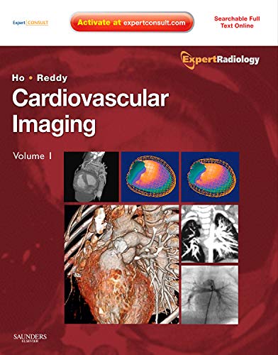 9781416053354: Cardiovascular Imaging, 2-Volume Set: Expert Radiology Series