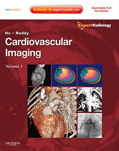 9781416053354: Cardiovascular Imaging, 2-Volume Set,: Expert Radiology Series