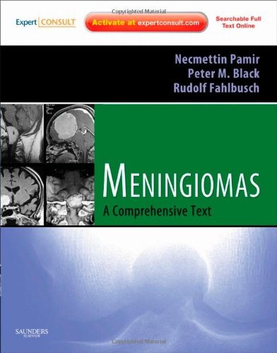 Stock image for Meningiomas for sale by Books Puddle