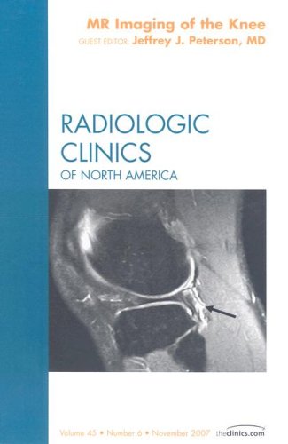 Stock image for MR IMAGING OF THE KNEE RADIOLOGIC CLINICS OF NORTH AMERICA for sale by AG Library