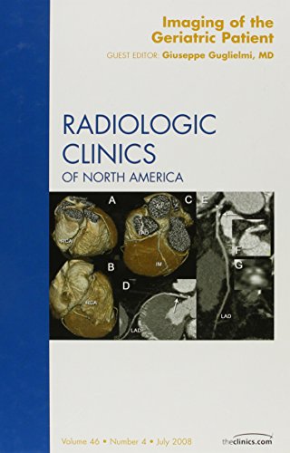 9781416060727: Imaging of the Geriatric Patient: An Issue of Radiologic Clinics: v. 46-4 (The Clinics: Radiology)