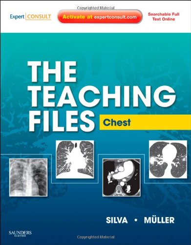 Imagen de archivo de The Teaching Files: Chest: Expert Consult - Online and Print (Teaching Files in Radiology) a la venta por dsmbooks