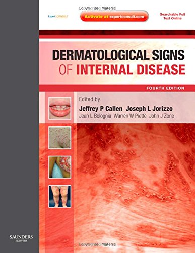 Imagen de archivo de Dermatological Signs of Internal Disease: Expert Consult - Online and Print a la venta por HPB-Red