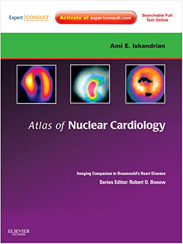 9781416061342: Atlas of Nuclear Cardiology: Imaging Companion to Braunwald's Heart Disease: Expert Consult - Online and Print (Imaging Techniques to Braunwald's Heart Disease)