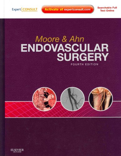 9781416062080: Endovascular Surgery: Expert Consult - Online and Print, with Video, 4e