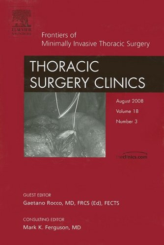 Imagen de archivo de Frontiers of Minimally Invasive Thoracic Surgery, An Issue of Thoracic Surgery Clinics (Volume 18-3) (The Clinics: Surgery, Volume 18-3) a la venta por St Vincent de Paul of Lane County