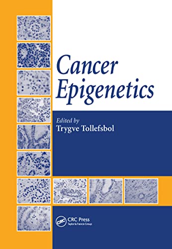 Cancer Epigenetics - Tollefsbol, Trygve (Edited by)