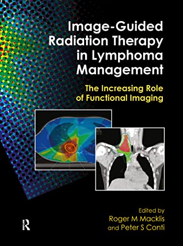 9781420058741: Image-Guided Radiation Therapy in Lymphoma Management: The Increasing Role of Functional Imaging