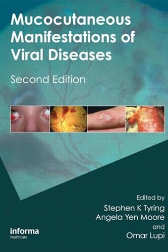 Stock image for Mucocutaneous Manifestations of Viral Diseases: An Illustrated Guide to Diagnosis and Management for sale by WookieBooks