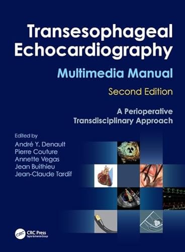 9781420080704: Transesophageal Echocardiography Multimedia Manual: A Perioperative Transdisciplinary Approach