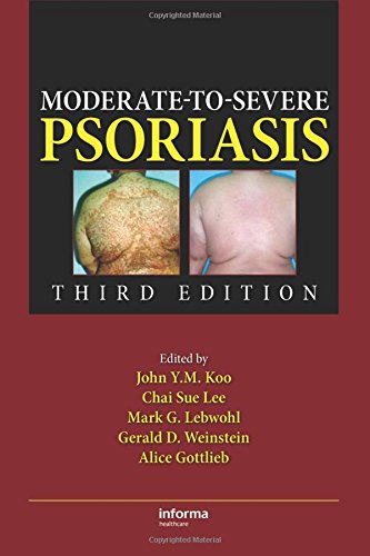 Beispielbild fr Moderate-To-Severe Psoriasis 3E zum Verkauf von Basi6 International