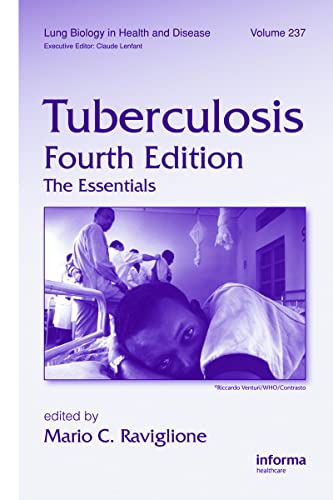 9781420090215: Tuberculosis: The Essentials, Fourth Edition: 237 (Lung Biology in Health and Disease)