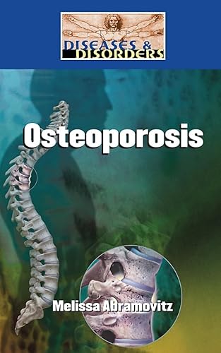 Beispielbild fr Osteoporosis (Diseases and Disorders) zum Verkauf von SecondSale