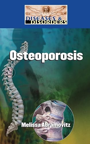 Stock image for Osteoporosis (Diseases and Disorders) for sale by SecondSale
