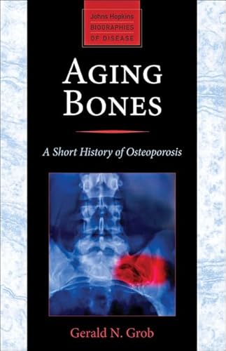 Stock image for Aging Bones : A Short History of Osteoporosis for sale by Better World Books: West