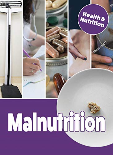 Beispielbild fr Malnutrition zum Verkauf von Better World Books
